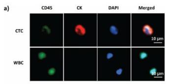 循環腫瘤細胞(circulating tumour cell) 循環腫瘤細胞(circulating tumour cell)