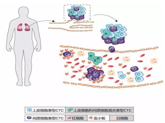 CTC循環(huán)腫瘤細胞的分類