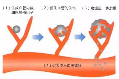 CTC檢查是測定血液中流動癌細胞的一種檢查